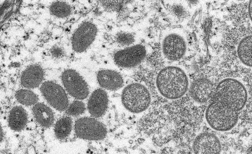 圖為猴痘病毒粒子。（圖取自美國疾管署網頁cdc.gov）
