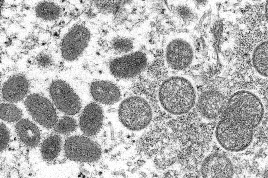 A microscopic view of the monkeypox virus.
