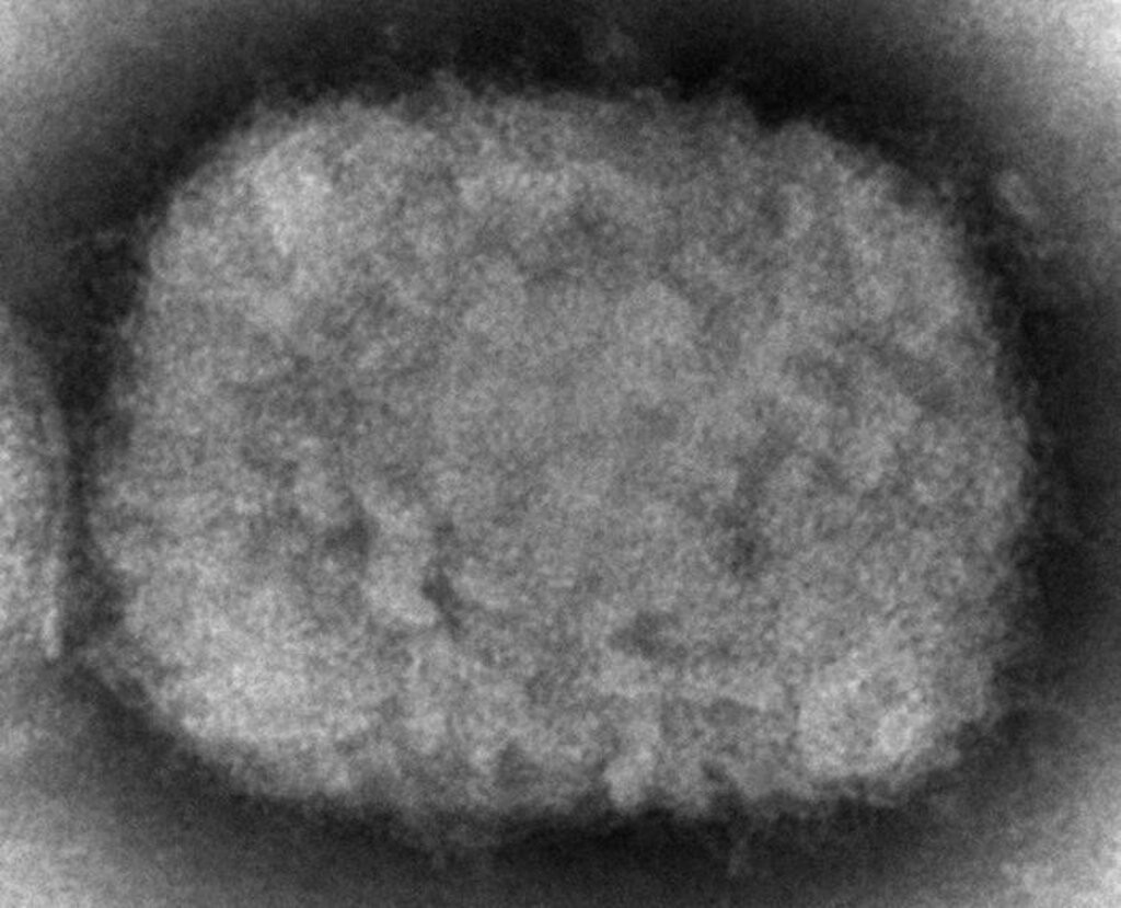 圖為電子顯微鏡下的一種猴痘病毒粒子，該樣本取自美國在2003年發生的土撥鼠將病毒傳染給飼主的事件。（圖／美聯社）
