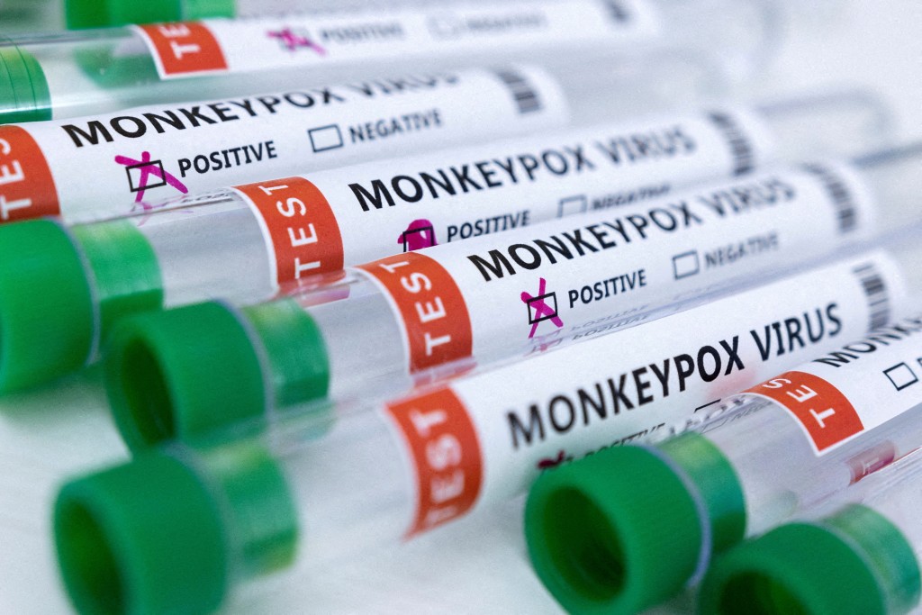 荷蘭一名10歲以下的男童與家人前往土耳其旅遊後確診猴痘，目前感染源不明。（圖／路透）
