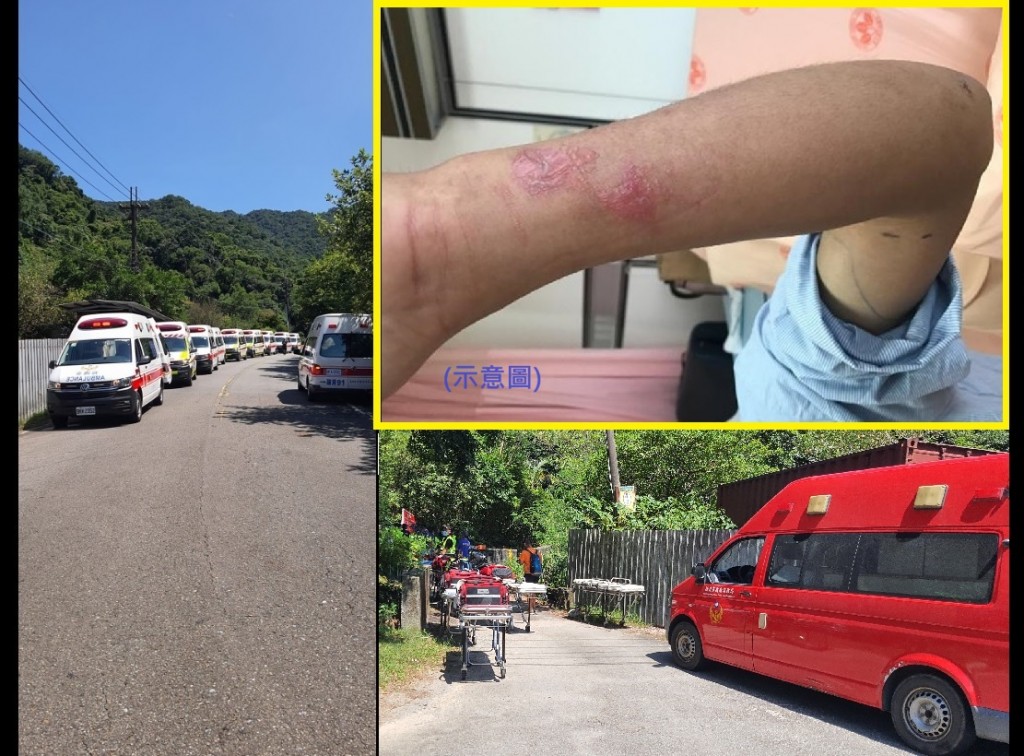 An illustrative image for bee stings (upper right). (Taiwan News Jessica OY collage/Taipei Veterans General Hospital, CNA, Facebook Ruifang Community ...