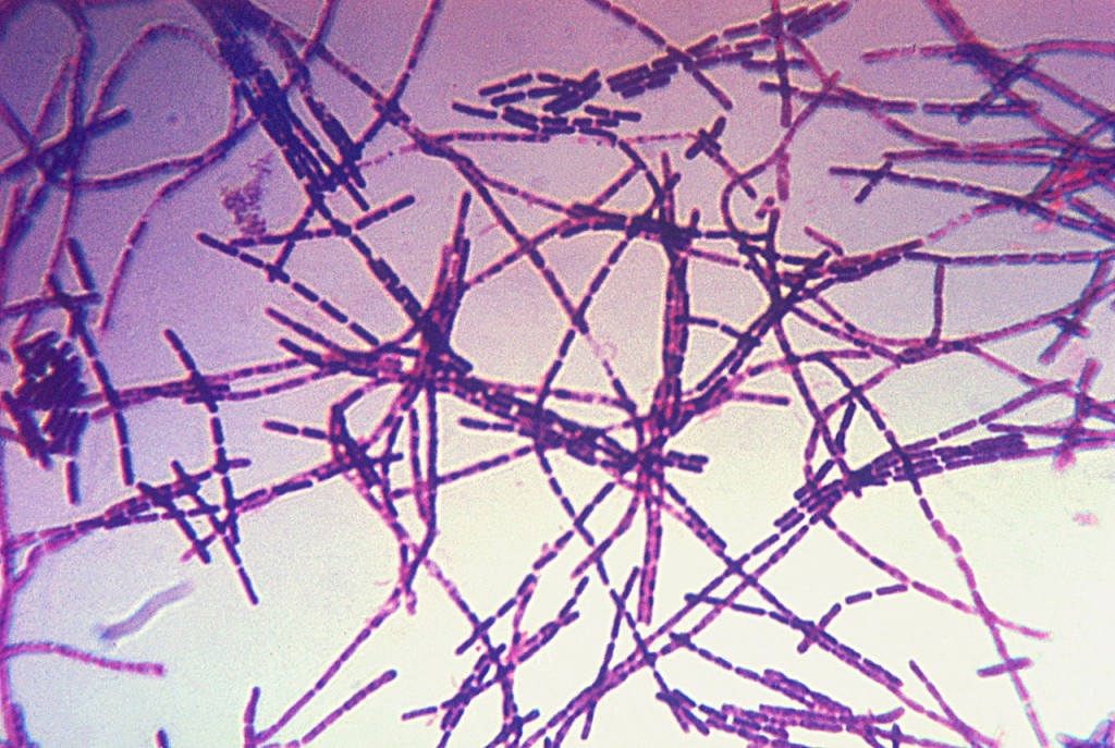 炭疽桿菌的革蘭氏染色顯微照片。（圖／維基百科）
