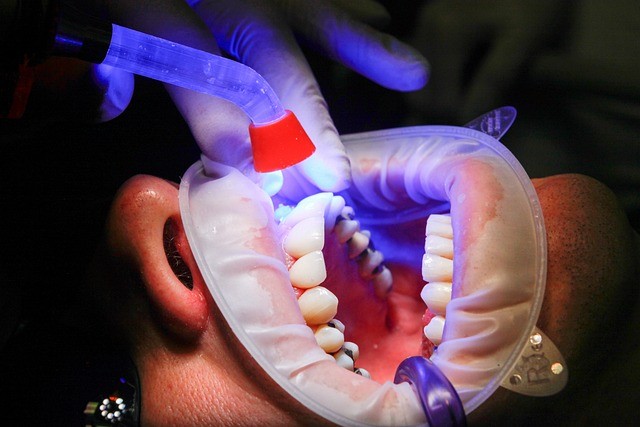 牙齒檢查示意圖。（圖／pixabay）
