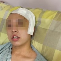 Taiwanese student beaten for scraping Maserati speaks to public